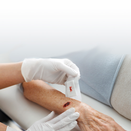 Close up of gloved hands gently removing a wound dressing from an elderly woman's arm  Close up of gloved hands gently removing a wound dressing from an elderly woman's arm
